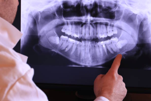 Best Emergency Gum Treatment in Jeffersonville, OH